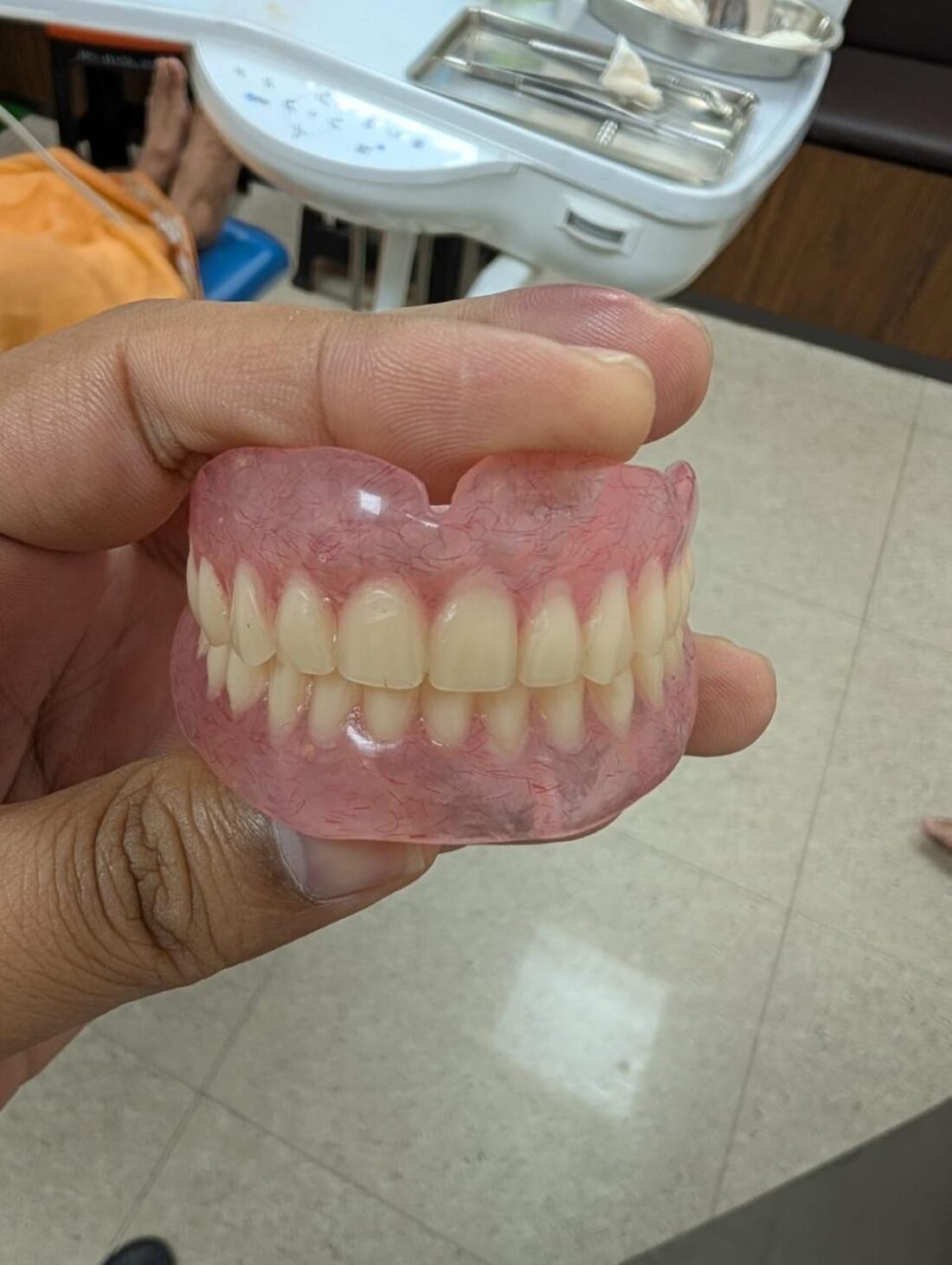 Complete denture prepared for a patient at Niyaz Dental Unit
