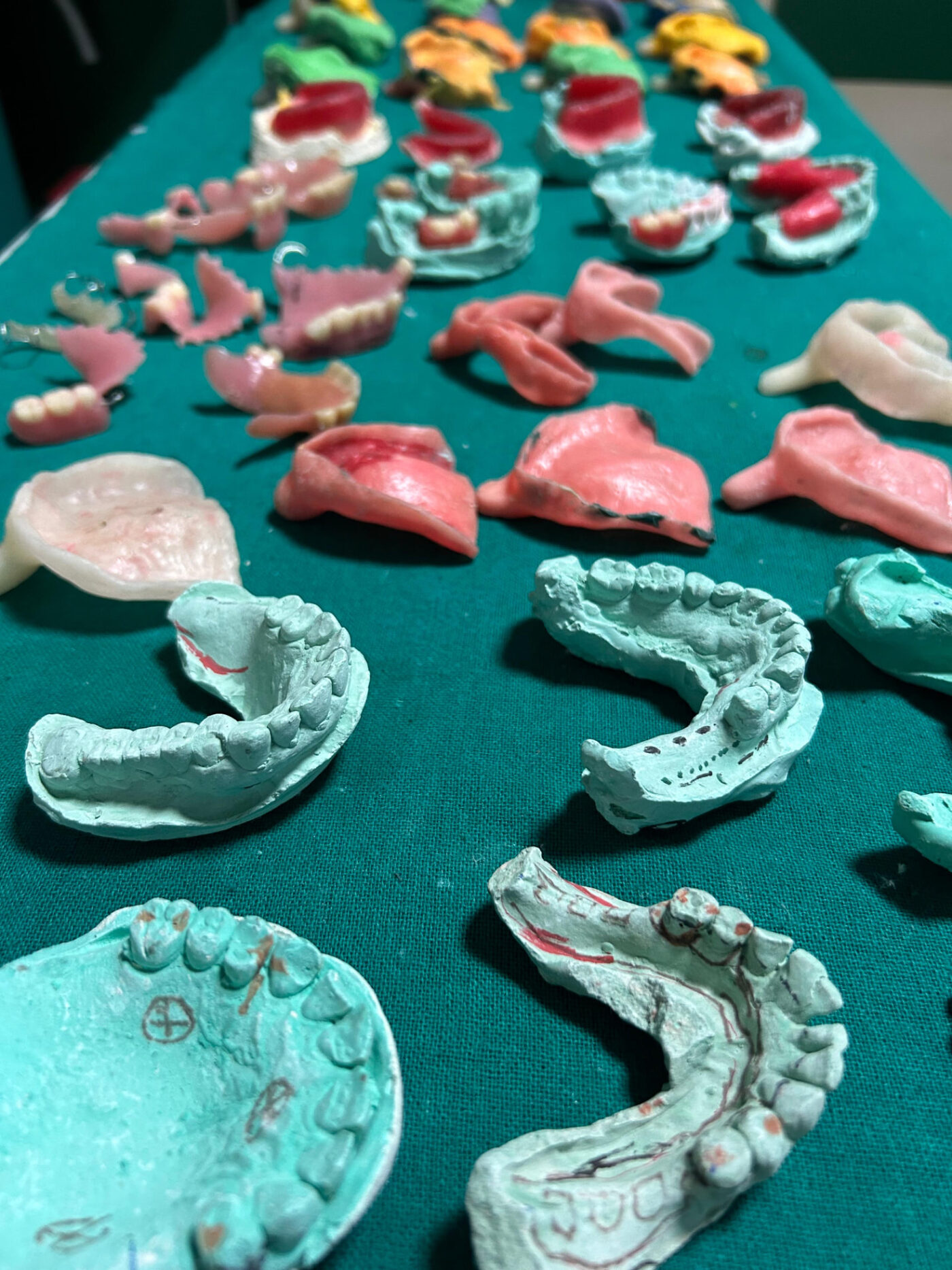 Dental casts and denture work prepared at Niyaz Dental Unit